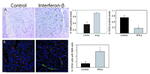 CD34 Antibody in Immunohistochemistry (IHC)