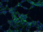 ABHD2 Antibody in Immunocytochemistry (ICC/IF)