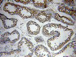 ABHD2 Antibody in Immunohistochemistry (Paraffin) (IHC (P))