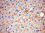 ABHD2 Antibody in Immunohistochemistry (Paraffin) (IHC (P))