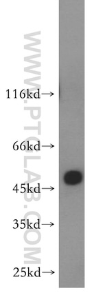 ABHD2 Antibody in Western Blot (WB)