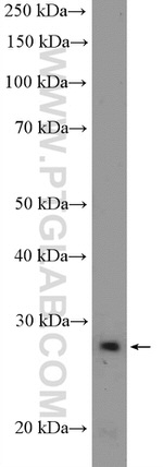 ACRV1 Antibody in Western Blot (WB)