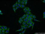 ACRV1 Antibody in Immunocytochemistry (ICC/IF)