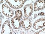 ACRV1 Antibody in Immunohistochemistry (Paraffin) (IHC (P))