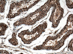 DDX3Y Antibody in Immunohistochemistry (Paraffin) (IHC (P))