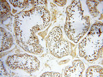 DDX3Y Antibody in Immunohistochemistry (Paraffin) (IHC (P))