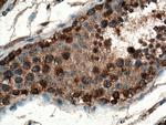 DDX3Y Antibody in Immunohistochemistry (Paraffin) (IHC (P))