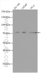 DDX3Y Antibody in Western Blot (WB)