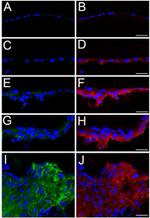 CD44 Antibody in Immunohistochemistry (IHC)