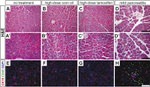 CD45 Antibody in Immunohistochemistry (Paraffin) (IHC (P))