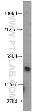 GPR116 Antibody in Western Blot (WB)
