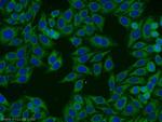 SLC27A2 Antibody in Immunocytochemistry (ICC/IF)