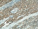 SLC27A2 Antibody in Immunohistochemistry (Paraffin) (IHC (P))