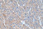 SLC27A2 Antibody in Immunohistochemistry (Paraffin) (IHC (P))