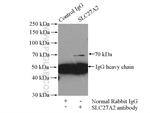 SLC27A2 Antibody in Immunoprecipitation (IP)