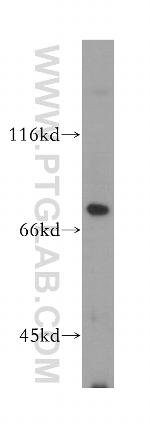 MAN1A2 Antibody in Western Blot (WB)