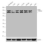 CD49b (Integrin alpha 2) Antibody in Western Blot (WB)