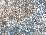 CD200 Antibody in Immunohistochemistry (Paraffin) (IHC (P))