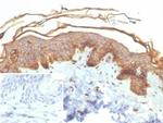 S100A16 (S100 calcium binding protein A16) Antibody in Immunohistochemistry (Paraffin) (IHC (P))