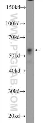 PARK2/Parkin Antibody in Western Blot (WB)