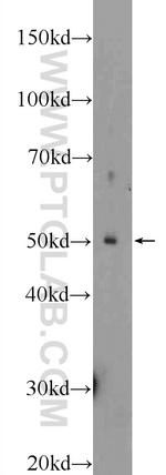 PARK2/Parkin Antibody in Western Blot (WB)