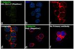 CD62P (P-Selectin) Antibody in Immunocytochemistry (ICC/IF)