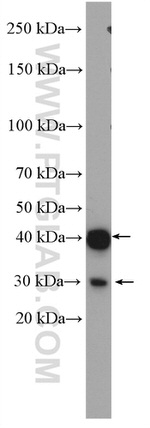 p38 MAPK Antibody in Western Blot (WB)