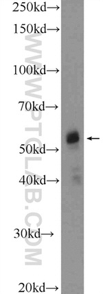 DAZ4 Antibody in Western Blot (WB)