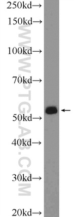 DAZ4 Antibody in Western Blot (WB)