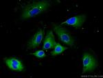 CCP1 Antibody in Immunocytochemistry (ICC/IF)