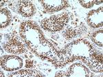 CCP1 Antibody in Immunohistochemistry (Paraffin) (IHC (P))