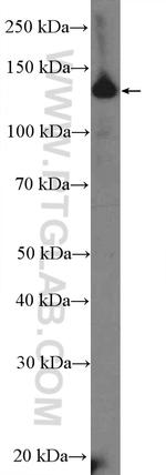 CCP1 Antibody in Western Blot (WB)