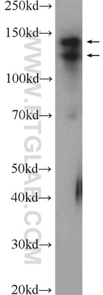 CCP1 Antibody in Western Blot (WB)