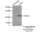 INTS5 Antibody in Immunoprecipitation (IP)