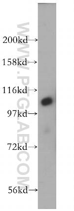 INTS5 Antibody in Western Blot (WB)