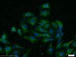 SRPK1 Antibody in Immunocytochemistry (ICC/IF)