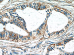 SRPK1 Antibody in Immunohistochemistry (Paraffin) (IHC (P))