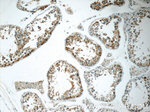 SRPK1 Antibody in Immunohistochemistry (Paraffin) (IHC (P))