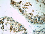 SRPK1 Antibody in Immunohistochemistry (Paraffin) (IHC (P))