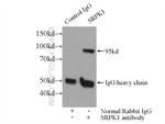 SRPK1 Antibody in Immunoprecipitation (IP)