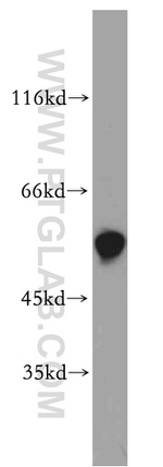 GNL1 Antibody in Western Blot (WB)