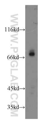 GNL1 Antibody in Western Blot (WB)