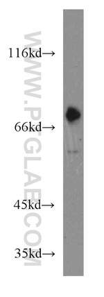 GNL1 Antibody in Western Blot (WB)