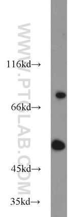 Kv1.3 Antibody in Western Blot (WB)