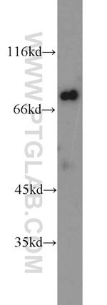 Kv1.3 Antibody in Western Blot (WB)