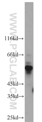 Kv1.3 Antibody in Western Blot (WB)