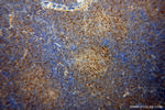 DOK2 Antibody in Immunohistochemistry (Paraffin) (IHC (P))