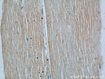 SREBF1 Antibody in Immunohistochemistry (Paraffin) (IHC (P))