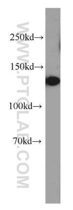 SREBF1 Antibody in Western Blot (WB)