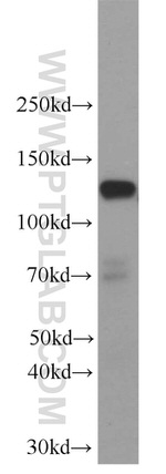 SREBF1 Antibody in Western Blot (WB)